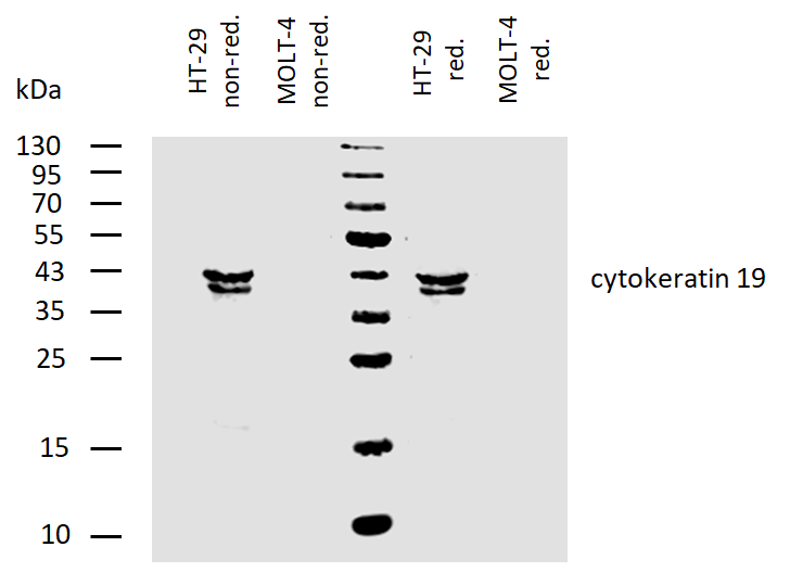 Anti-Cytokeratin 19 Purified