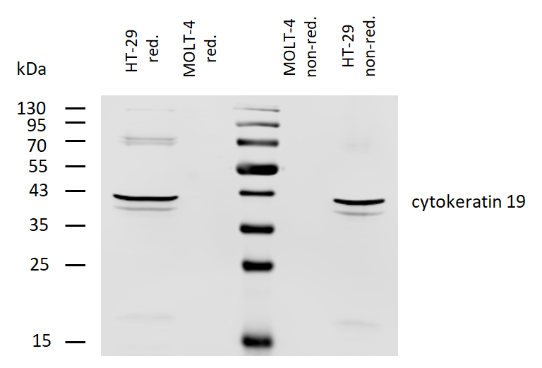 Cytokeratin 19 Antibody (Biotin)