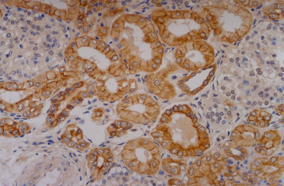 Anti-Cytokeratin 18 Purified