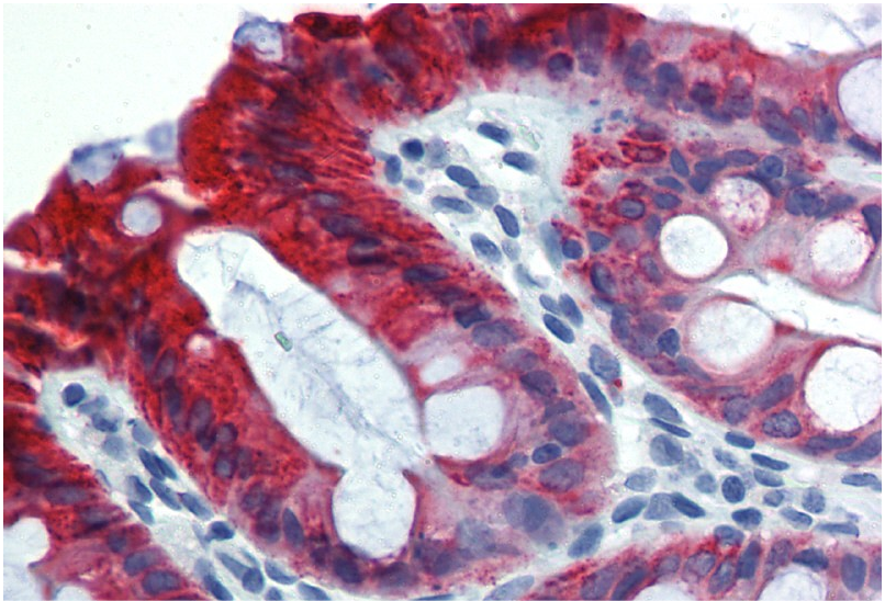 Anti-Cytokeratin 18 Purified