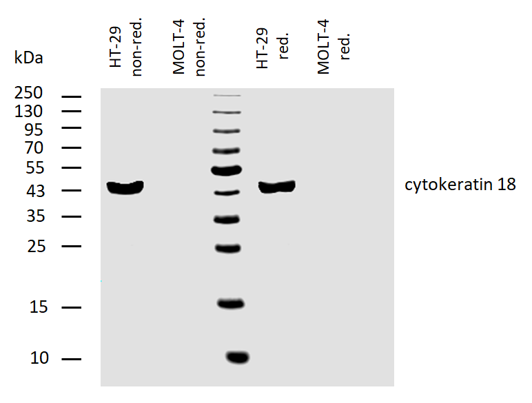 Cytokeratin 18 antibody