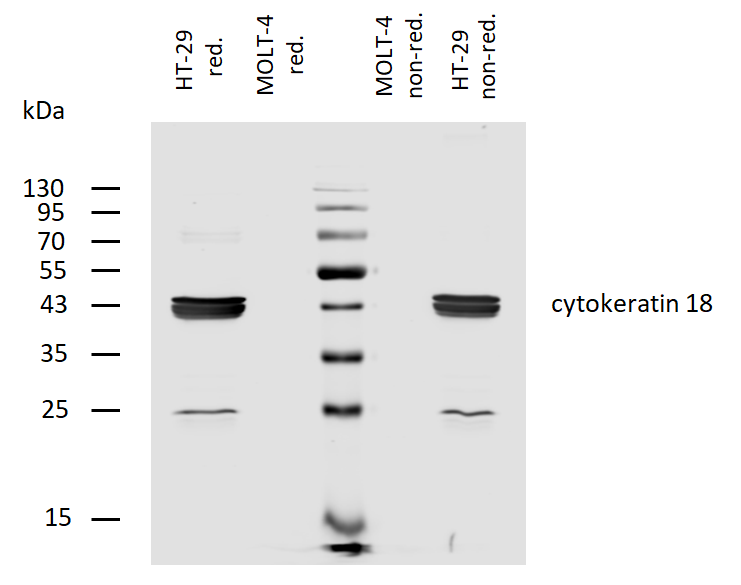 Cytokeratin 18 Antibody (Biotin)
