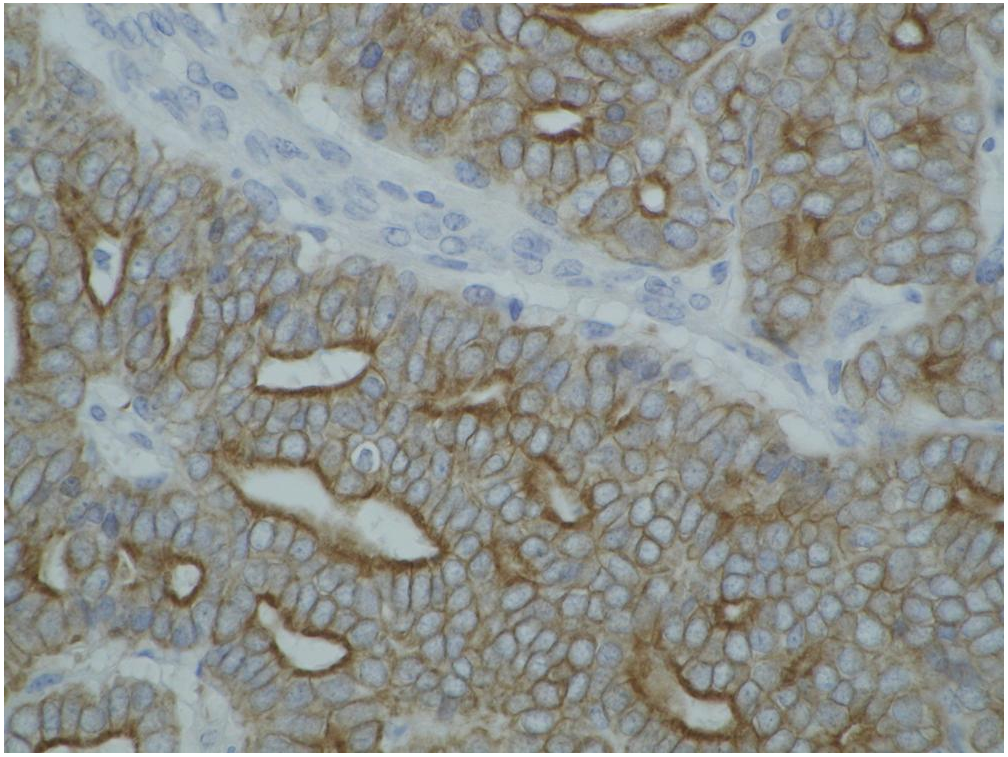 pan Cytokeratin antibody