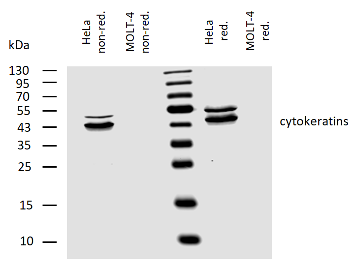 pan Cytokeratin antibody