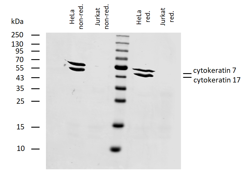 Cytokeratin 7/17 antibody