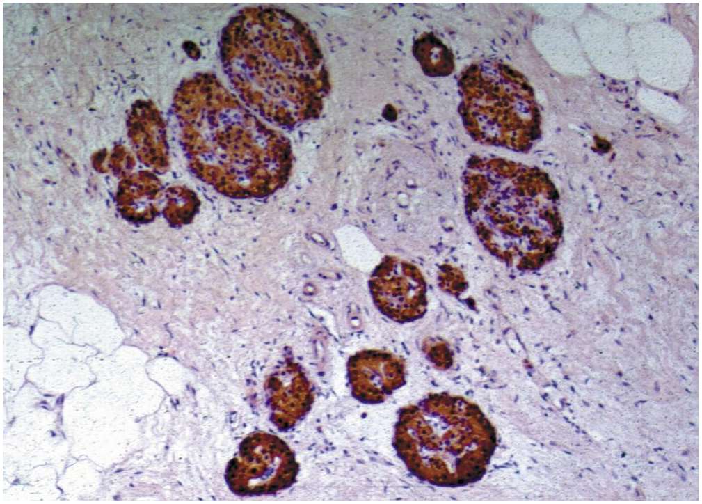 C-peptide Antibody
