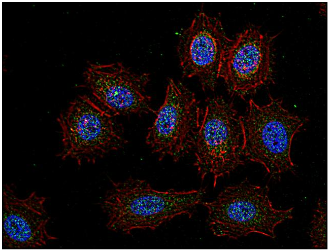 CSK Antibody