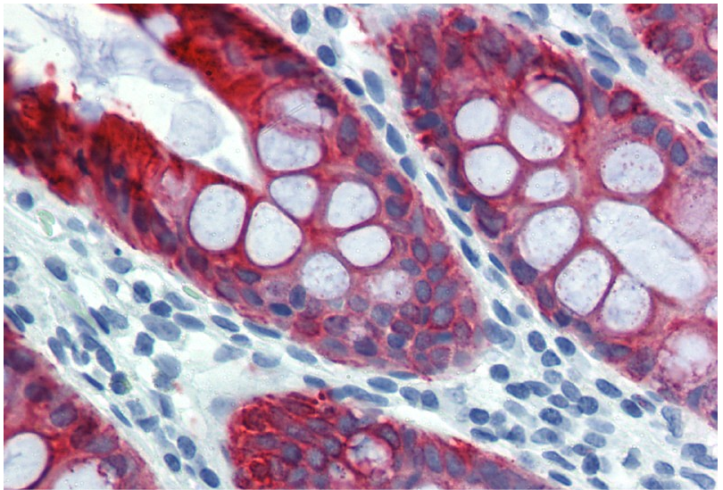 Cytokeratin 18 antibody