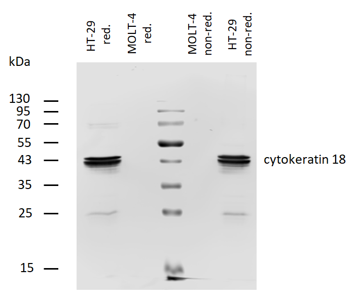 Cytokeratin 18 Antibody (Biotin)