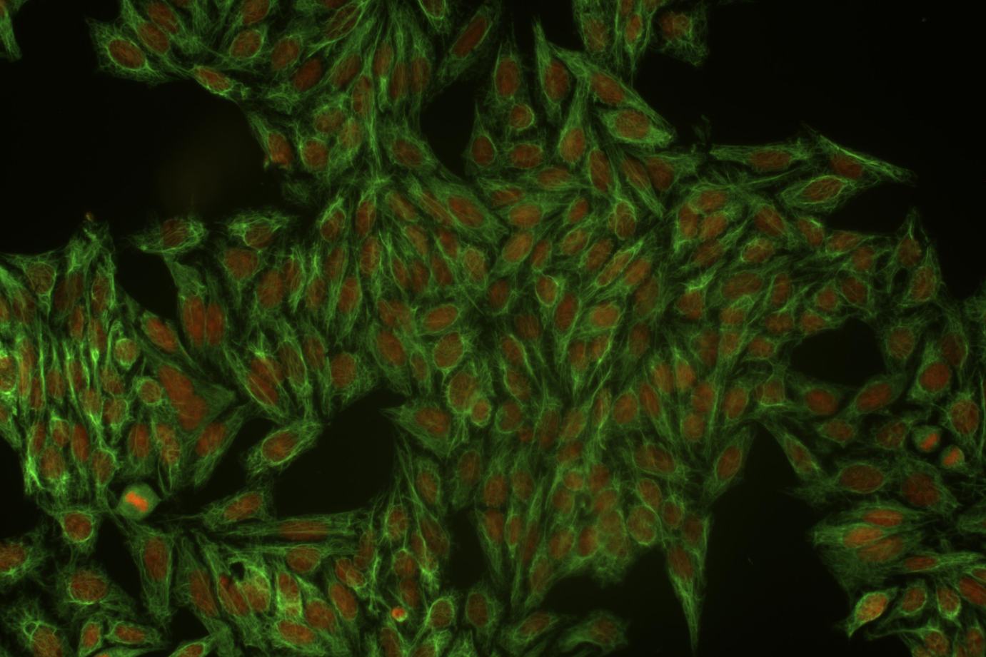 Cytokeratin 18 antibody