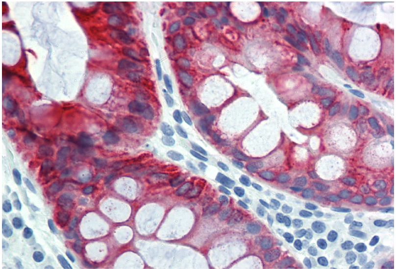 Anti-Cytokeratin 18 Purified