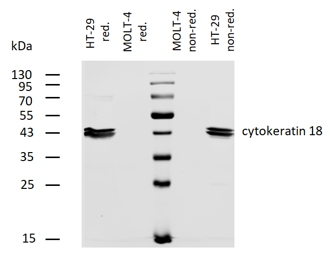 Cytokeratin 18 antibody (Biotin)