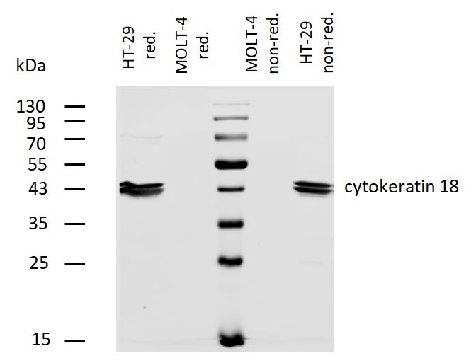 Anti-Cytokeratin 18 Biotin