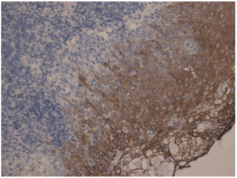 Cytokeratin 10/13 Antibody