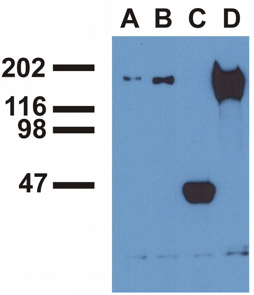 EGFR (phospho-Tyr992) antibody