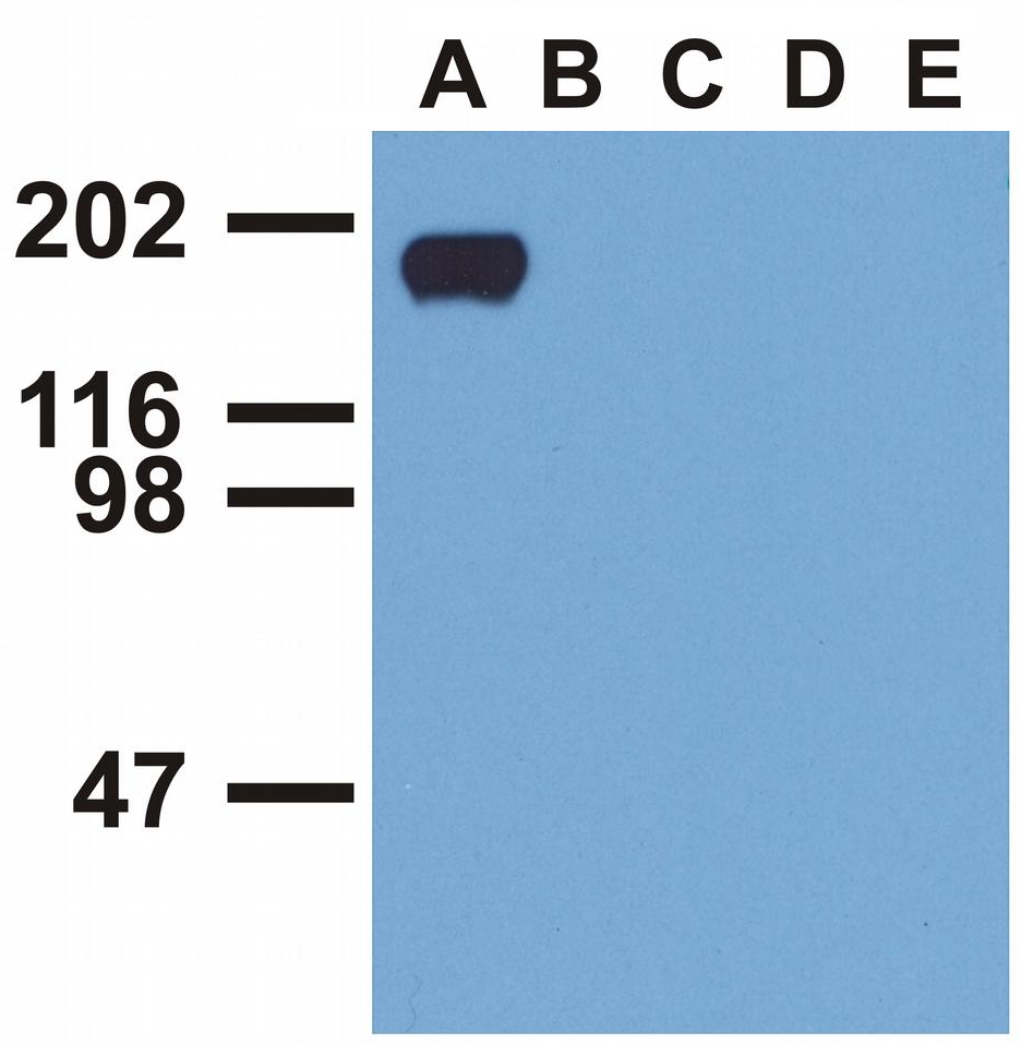 EGFR (phospho-Tyr992) antibody