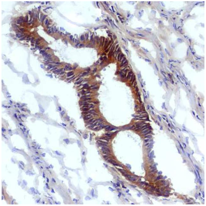 Nitrotyrosine Antibody