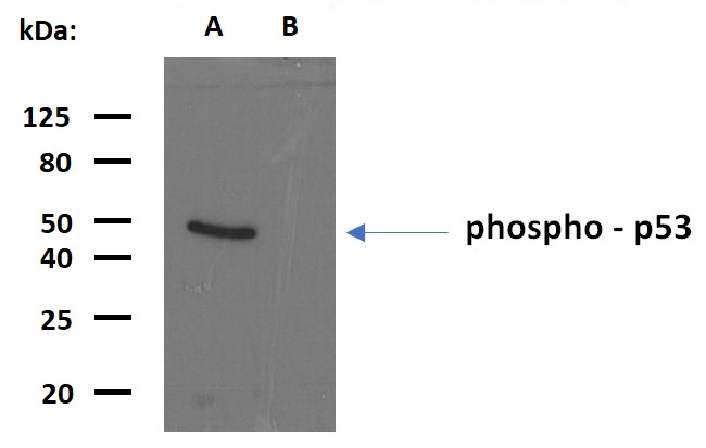 p53 (phospho-Ser392) antibody