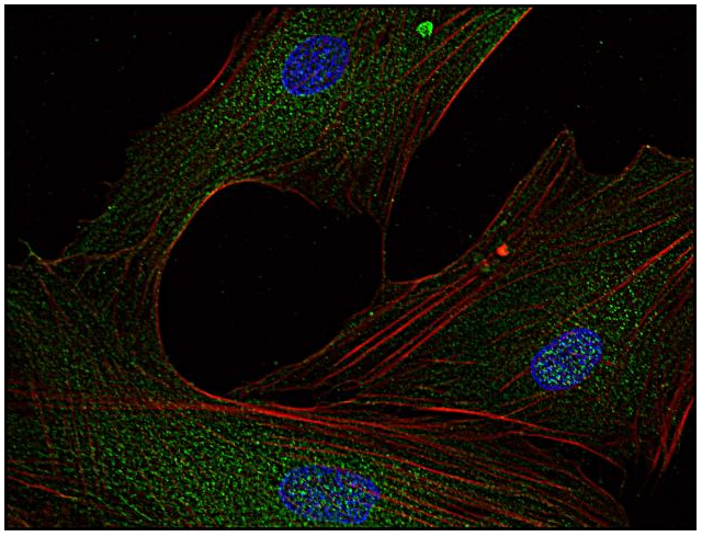 Fyn antibody