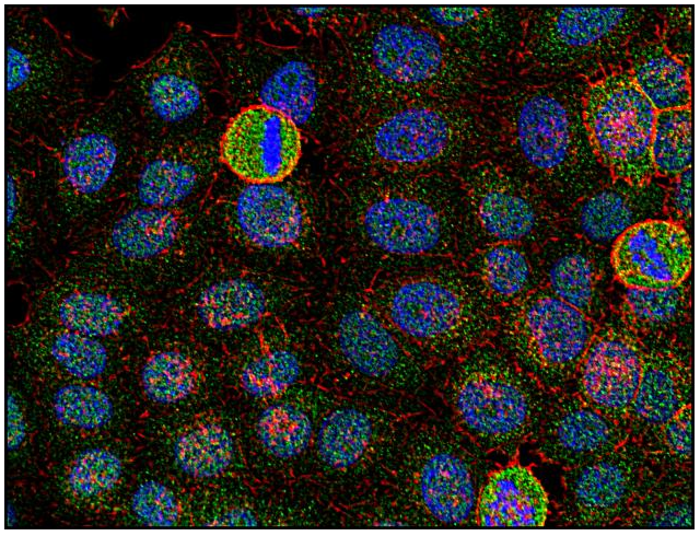 Fyn antibody