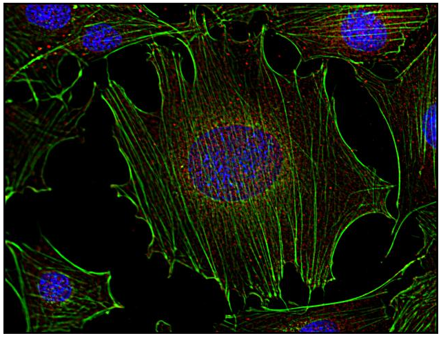 Fyn antibody