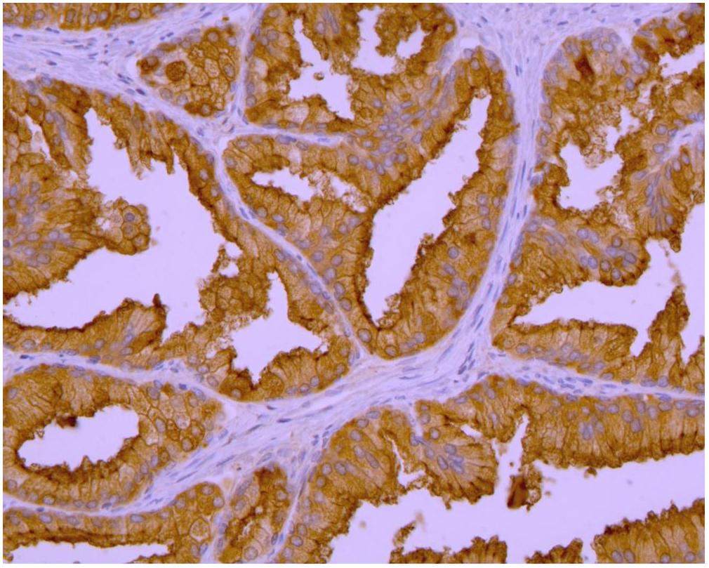 Anti-PSMA Purified