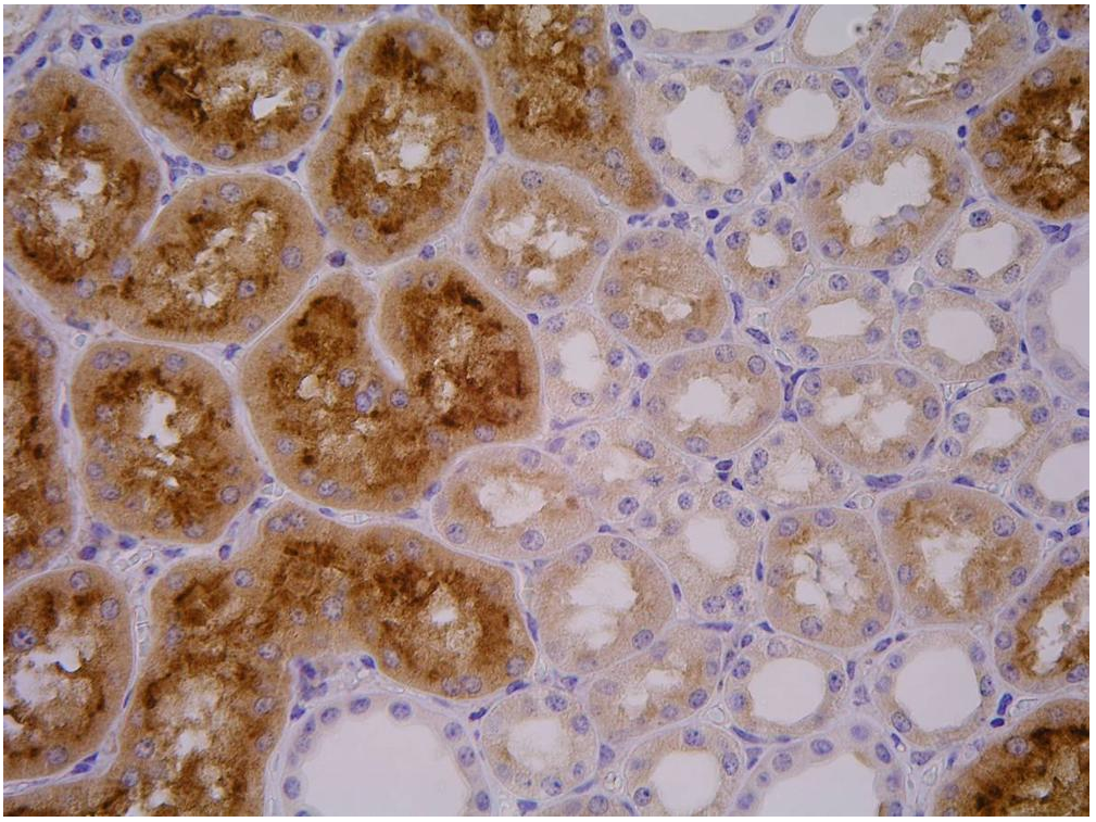 Anti-PSMA Purified