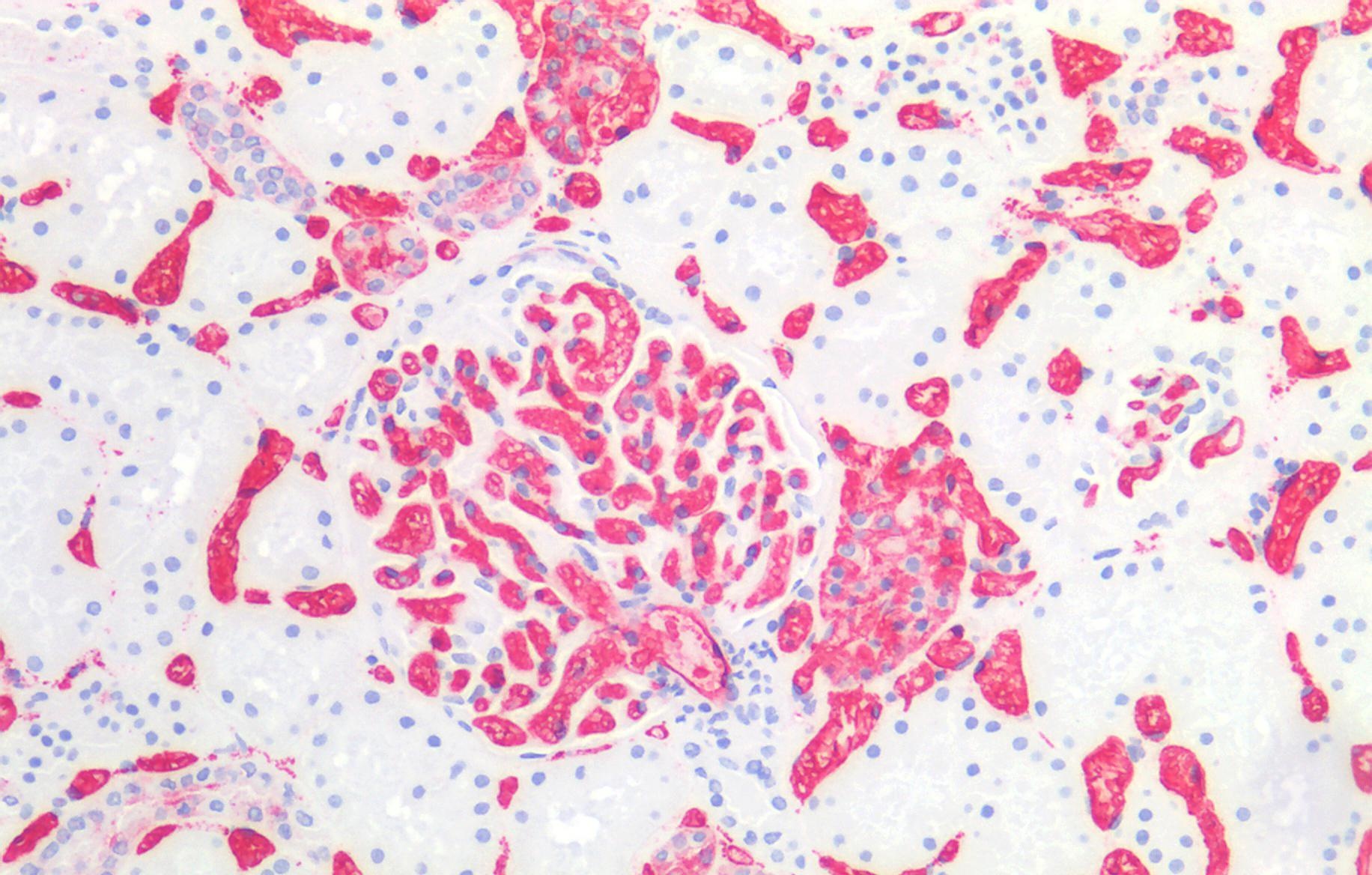 Blood Group A Antibody