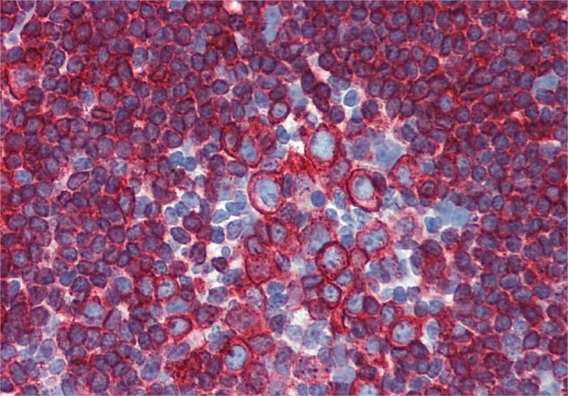 Anti-HLA-DR/DP Purified