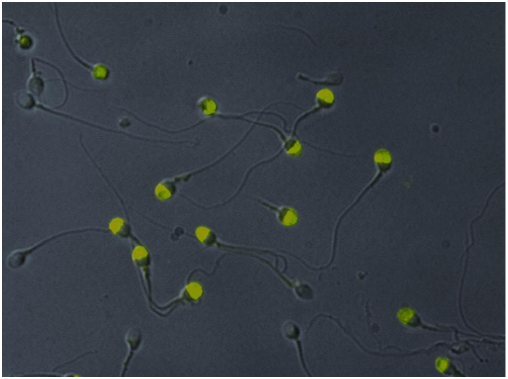 Intra-Acrosomal Protein antibody