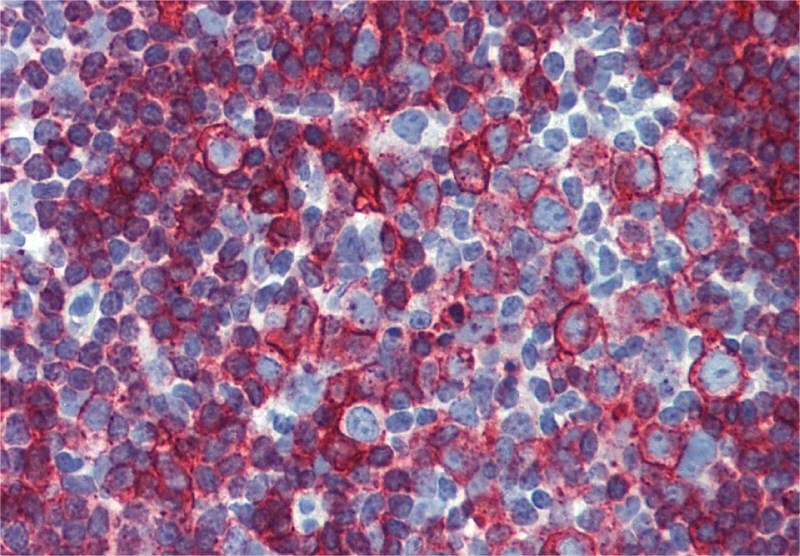 Anti-HLA-DR/DP Purified