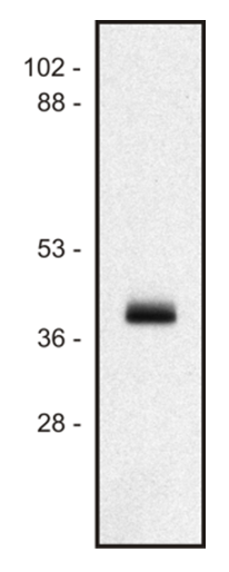HLA Class I Antibody