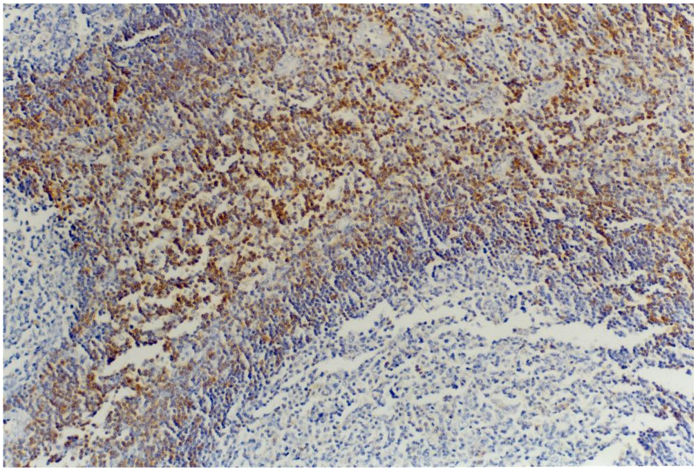 CD45RB Antibody