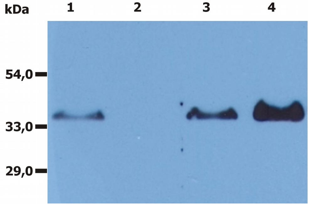 CD20 antibody