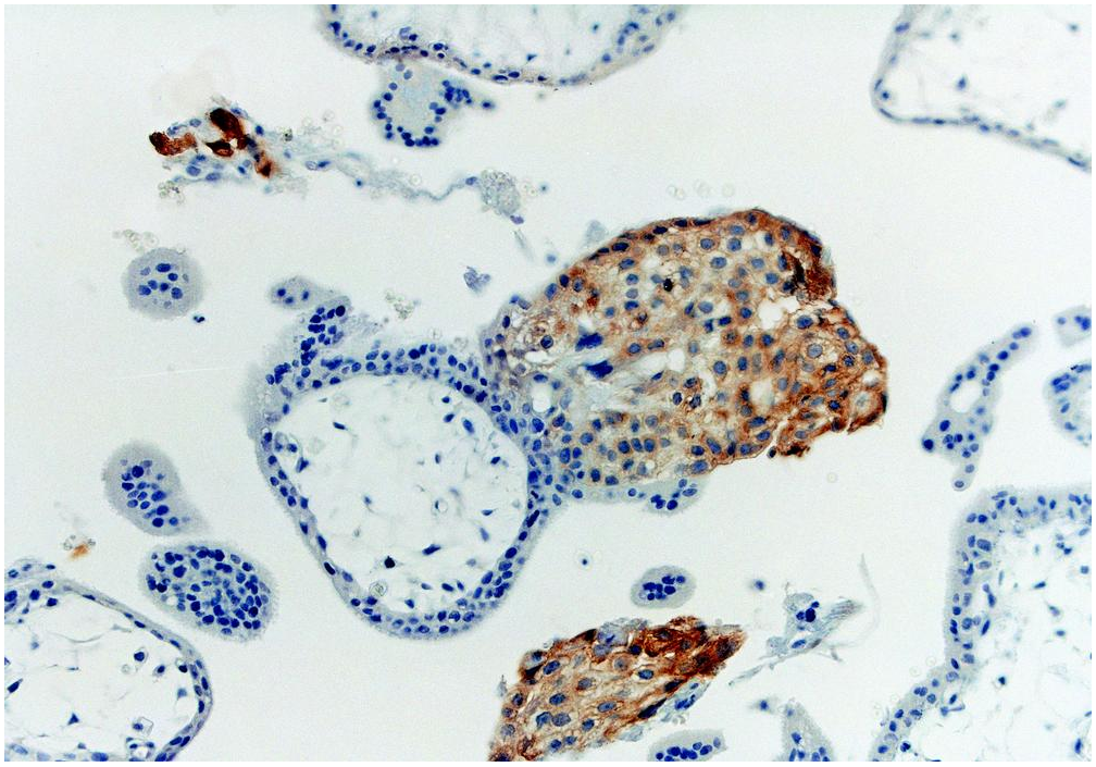 HLA-G antibody