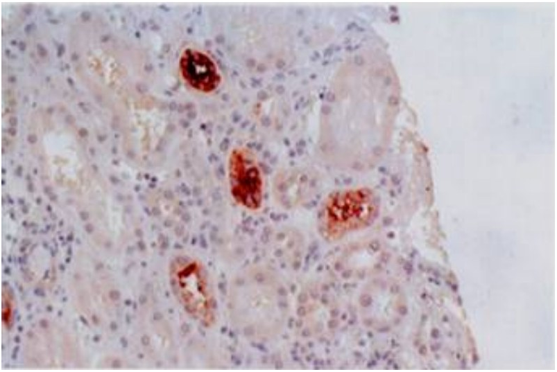 Anti-HLA-G Purified