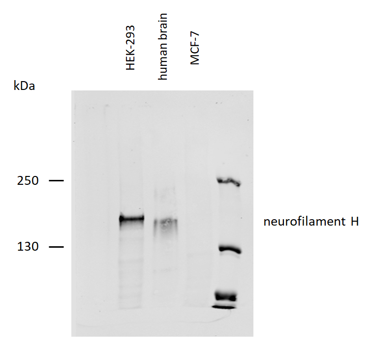 Neurofilament heavy protein antibody