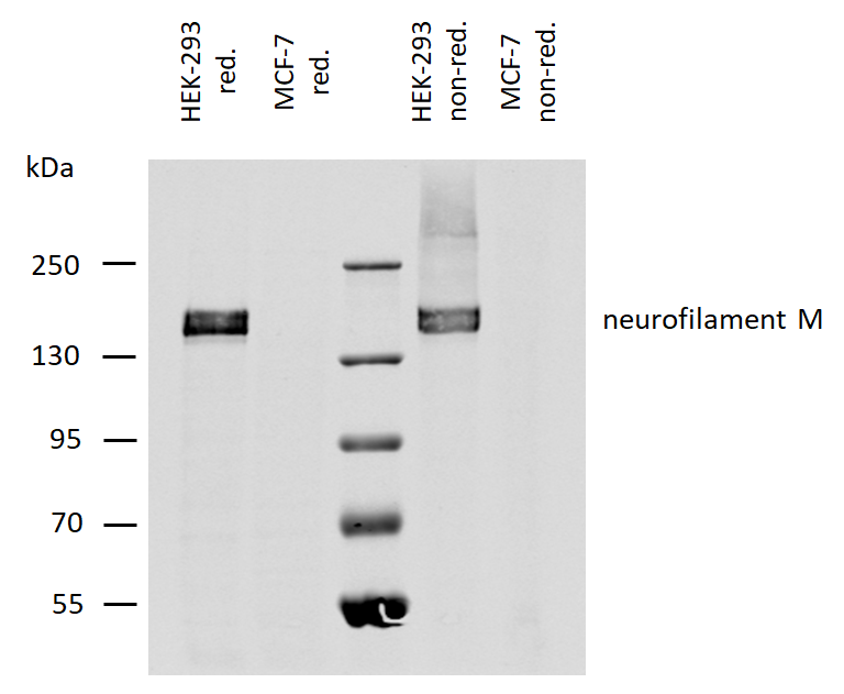 Neurofilament M Antibody