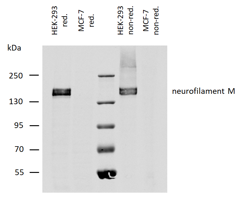Neurofilament medium protein antibody