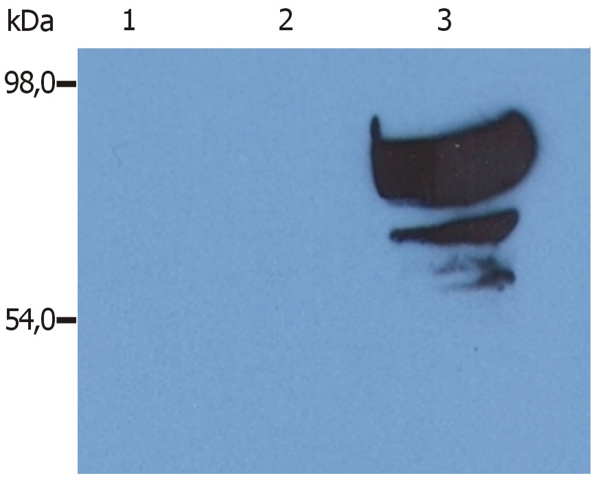 Transferrin Antibody