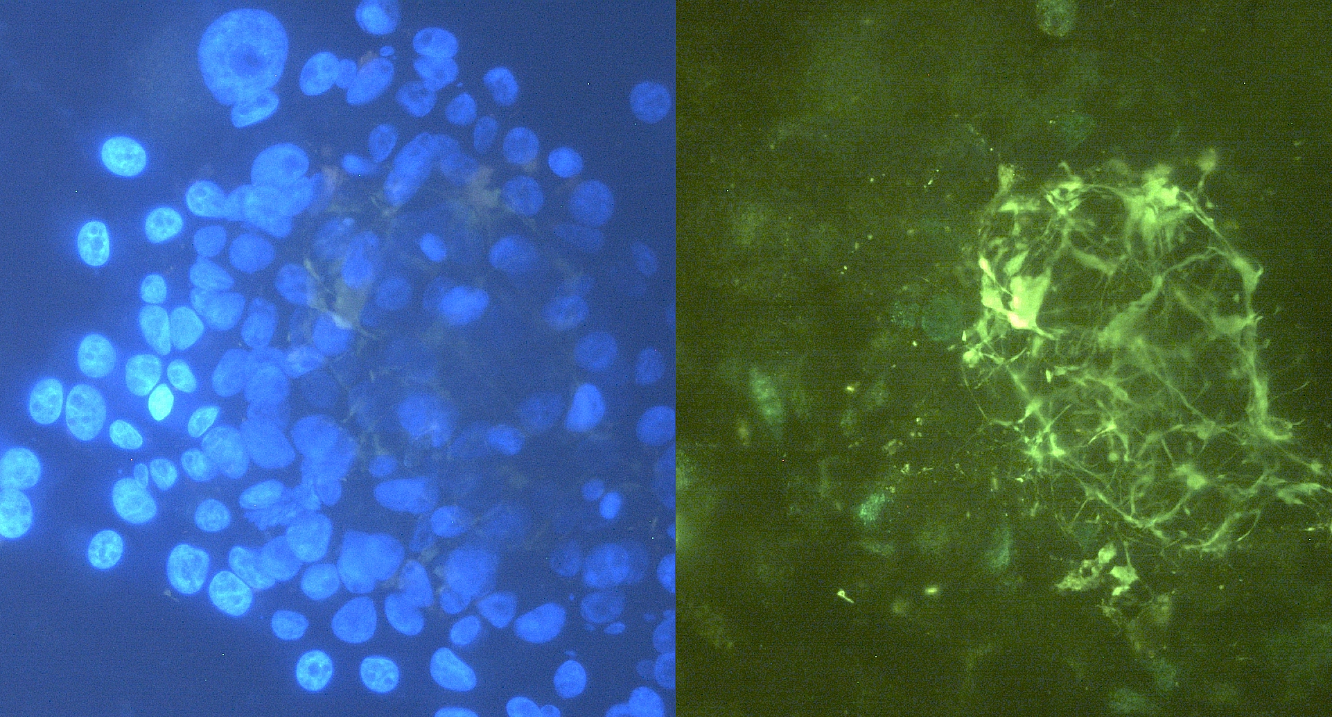 Anti-Hu Tenascin C Purified