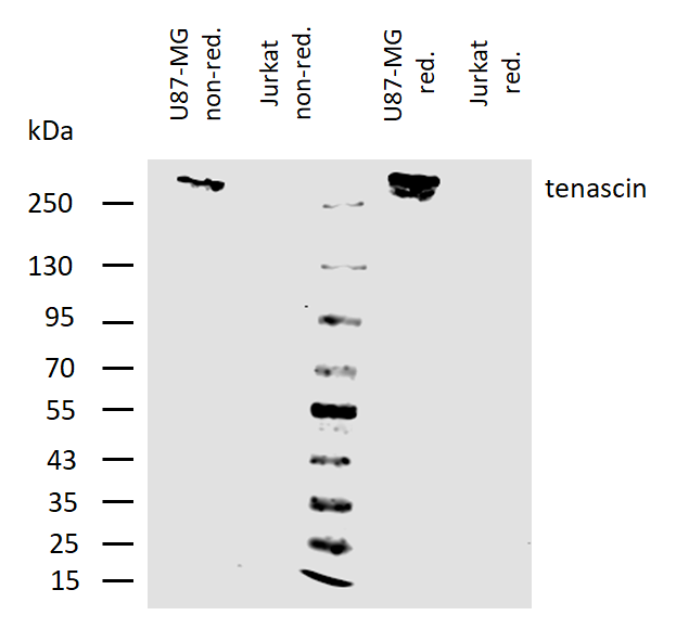 Tenascin antibody