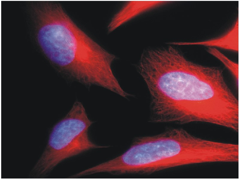 alpha tubulin antibody