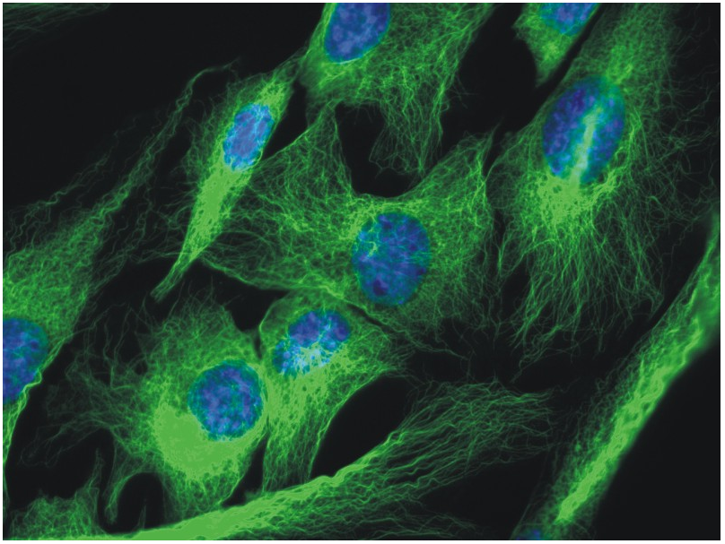 alpha tubulin antibody