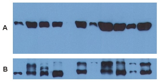 alpha tubulin antibody