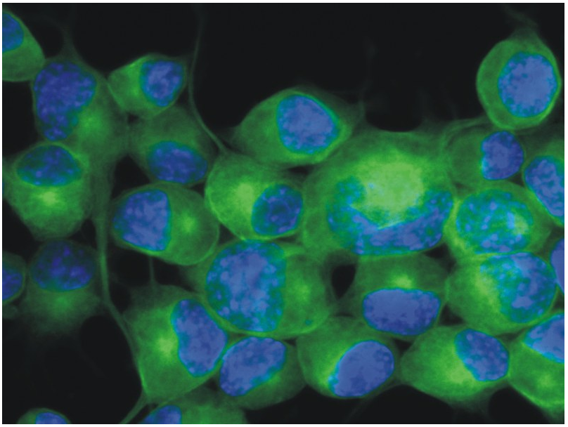 Anti-betaIII-Tubulin Purified
