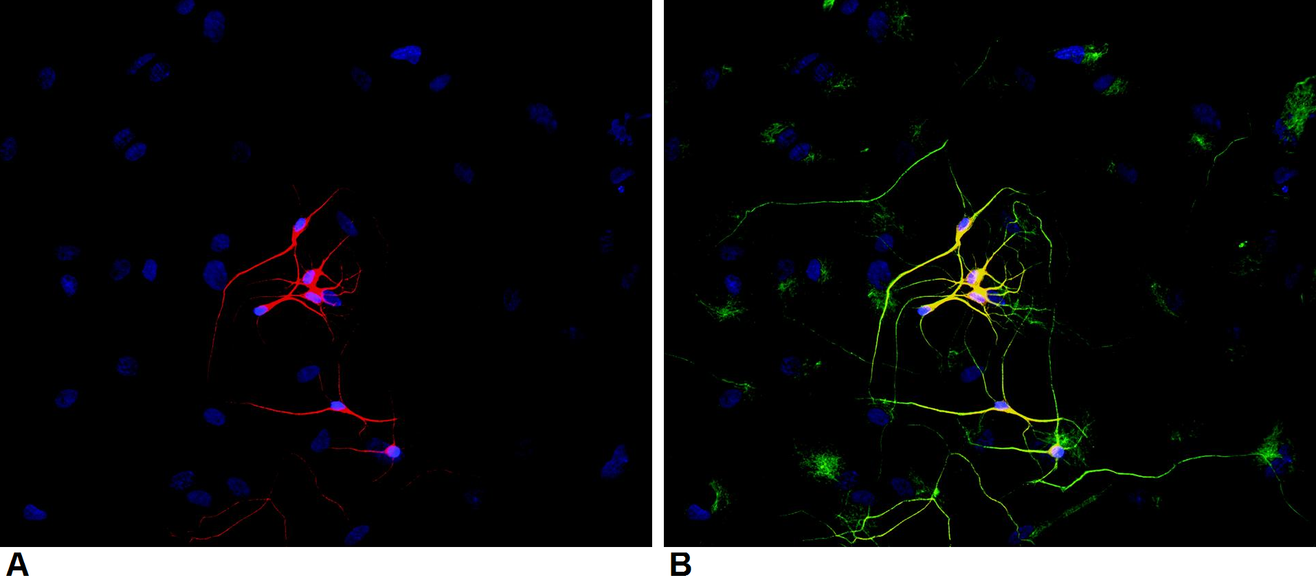 Anti-betaIII-Tubulin Purified