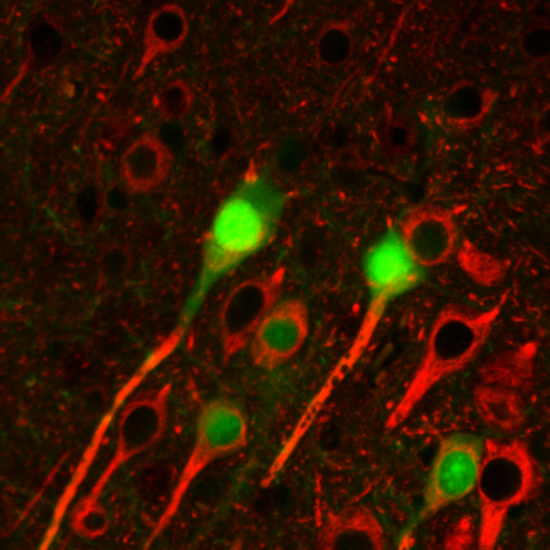 Anti-betaIII-Tubulin Purified