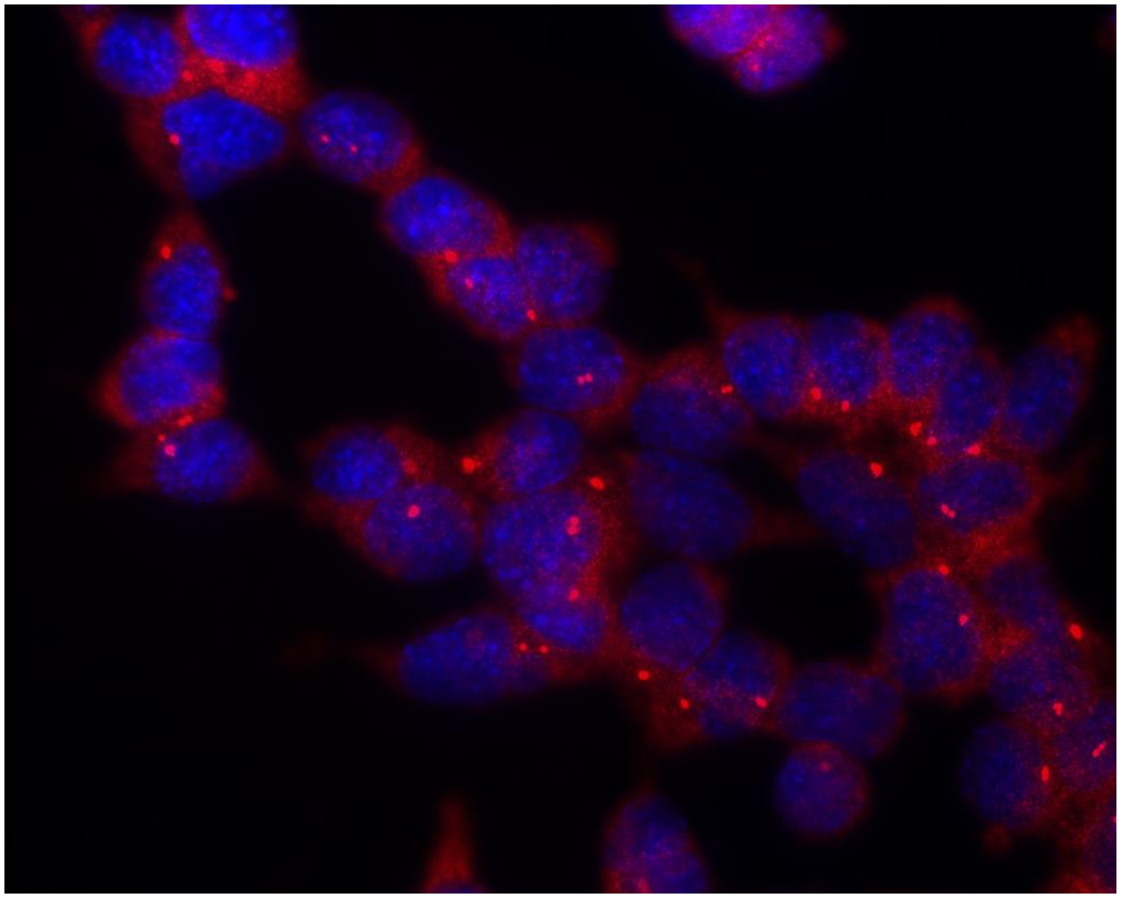 gamma Tubulin antibody