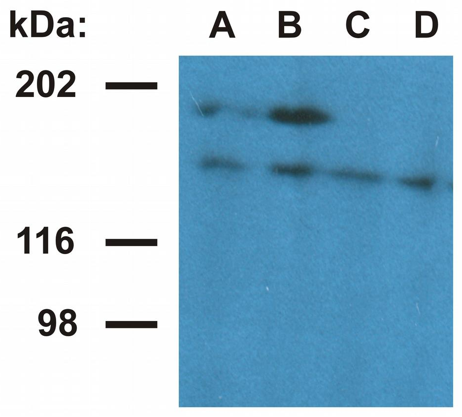 UBN1 Antibody